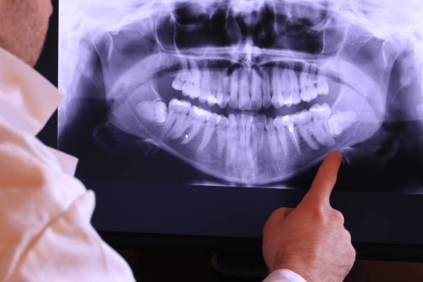 Best Emergency Dental Care for Broken or Chipped Teeth in Wrightstown, WI